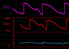 Monitor electro